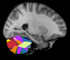 Buckner2011_JNeurophysiol_17networks_cerebellum-24.png