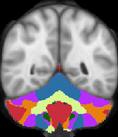 Buckner2011_JNeurophysiol_7networks_TightMask_axial.png