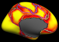 Yeo2011_JNeurophysiol_7networks_medial_confidence.png