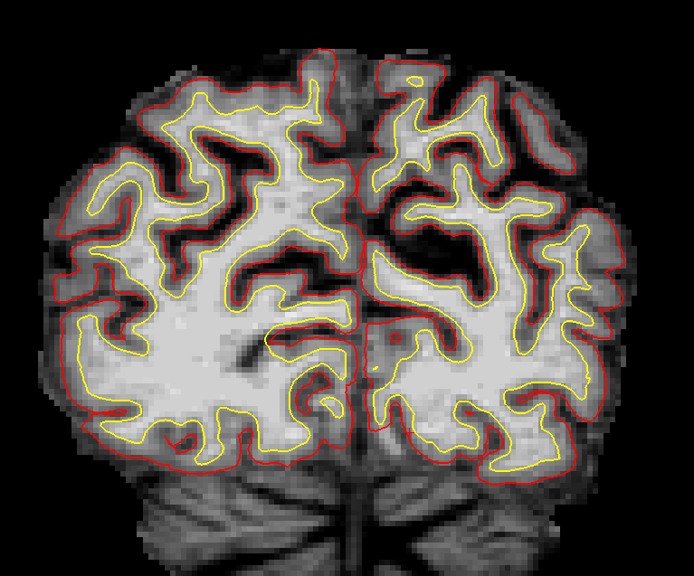 slice_57_unedited_2025.png