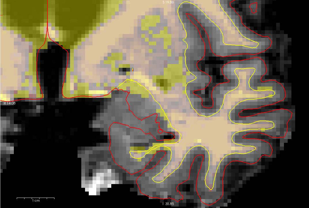 132_edited.png