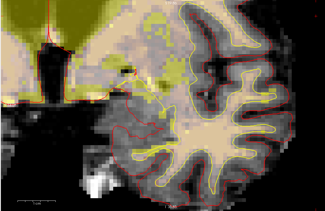 133_edited.png
