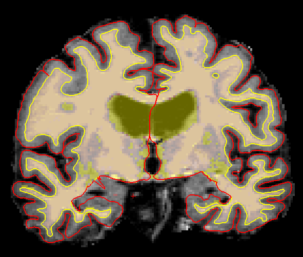 wm_over_brainmask_2025.png