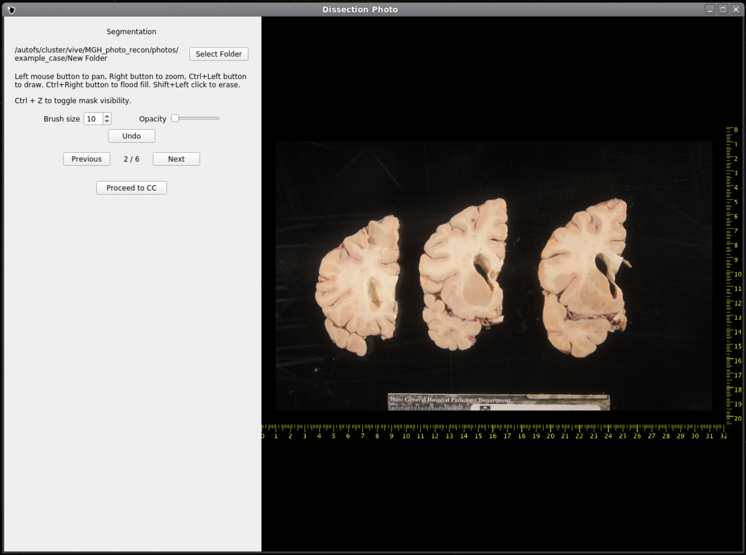 38_dissection_photo_gui_screen_3_noseg.png