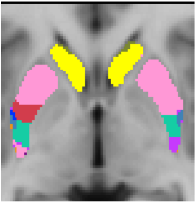 Choi2012_JNeurophysiol_17Network_striatum_axial_-2.png