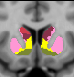 Choi2012_JNeurophysiol_17Network_striatum_coronal_12.png