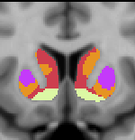 Choi2012_JNeurophysiol_7Network_striatum_coronal_12.png