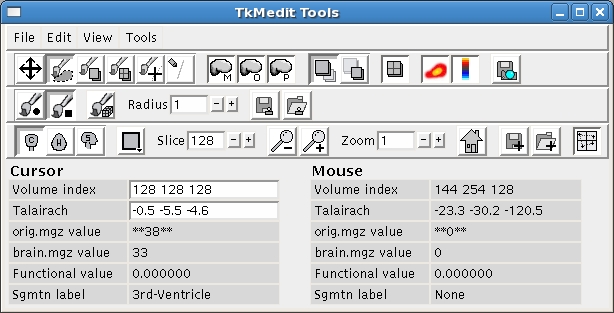 tkmedit_interface_tools.jpg