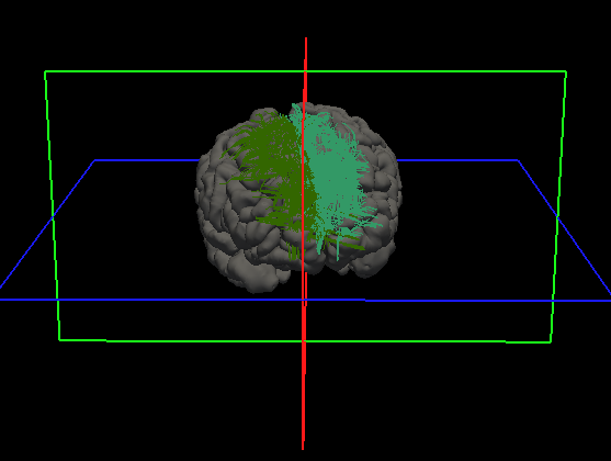 Clustered Streamlines 2.png