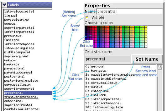 tksurfer_labels_dlog_edits.jpg