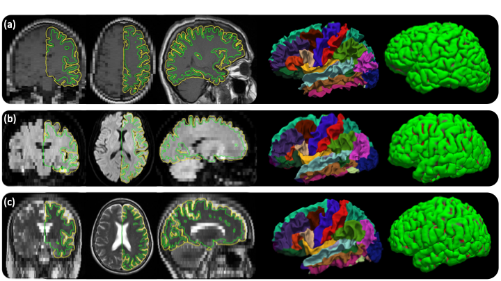 sample_output_recon_all_clinical.png